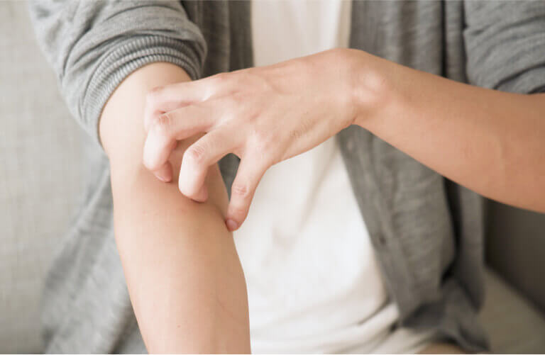 金属アレルギーの心配がない