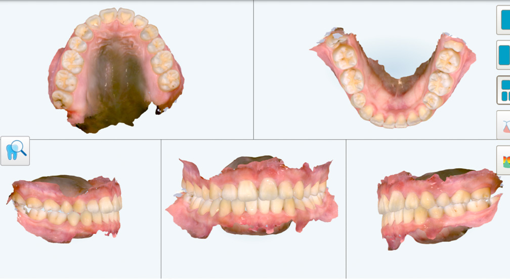 3Dシミュレーション
